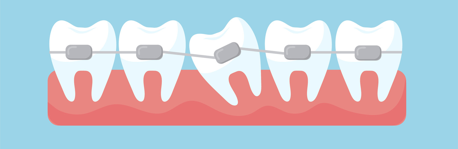 Ortodoncie MUDr. Petr Kolář, rovnátka, dentální hygiena, Tábor, Jihočeský kraj