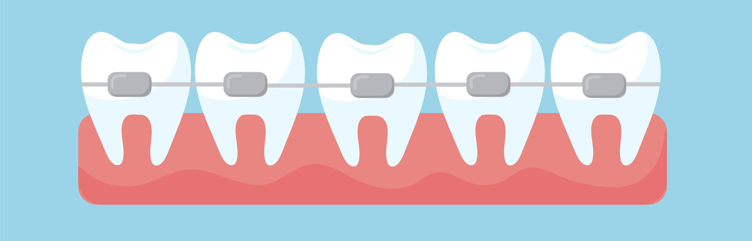 Ortodoncie MUDr. Petr Kolář, rovnátka, dentální hygiena, Tábor, Jihočeský kraj