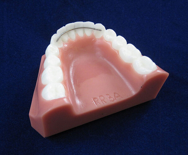 Ortodoncie MUDr. Petr Kolář, rovnátka, dentální hygiena – Dlahy a retainery